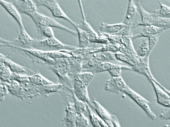 Equine Mesenchymal stomal cells adherent to plastic culture ware during cell expansion in vitro. 